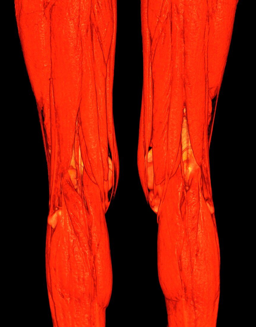 Knee muscles, illustration