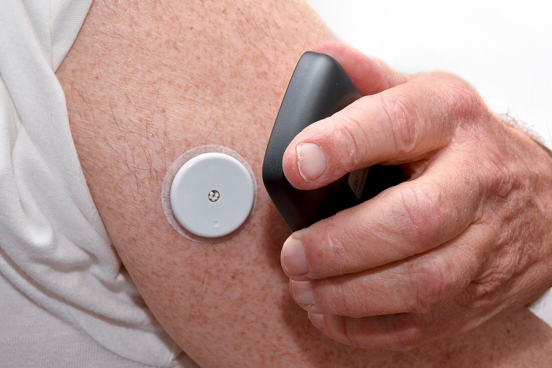 Glucose monitoring kit with subcutaneous sensor