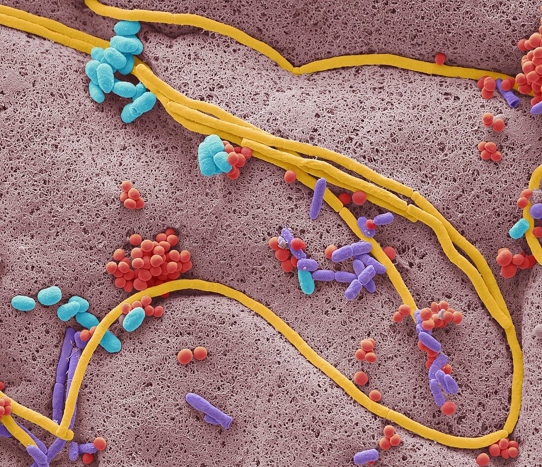 Bacteria found on mobile phone, SEM