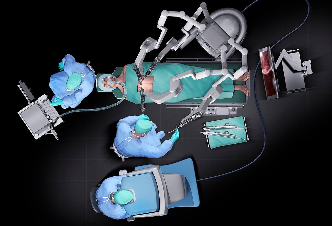Robotic surgery, illustration