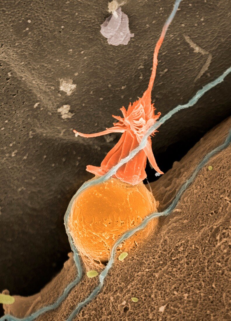 Hydroid nematocyst, SEM