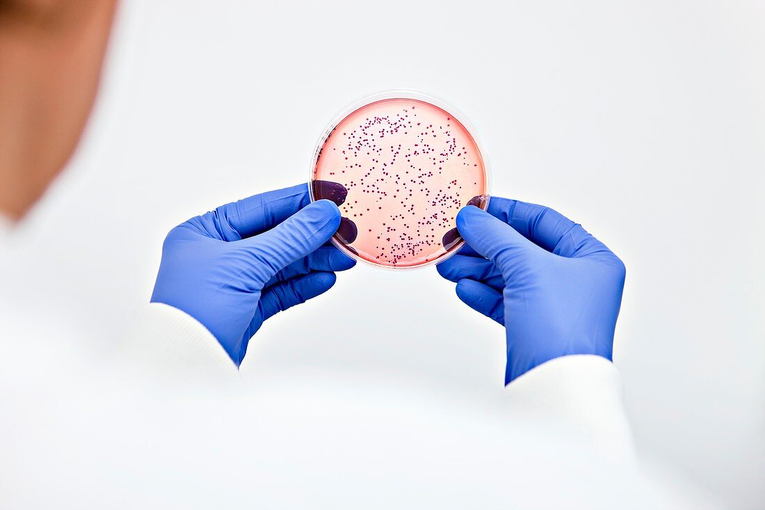 E. coli bacterial culture