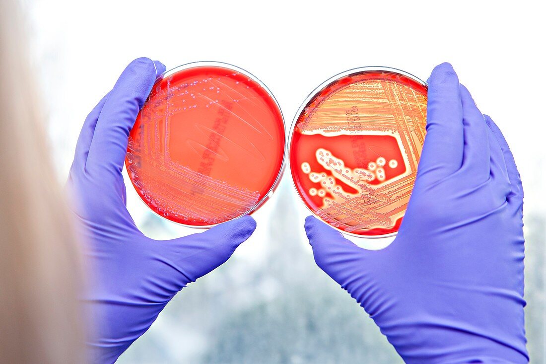 E. coli bacterial cultures