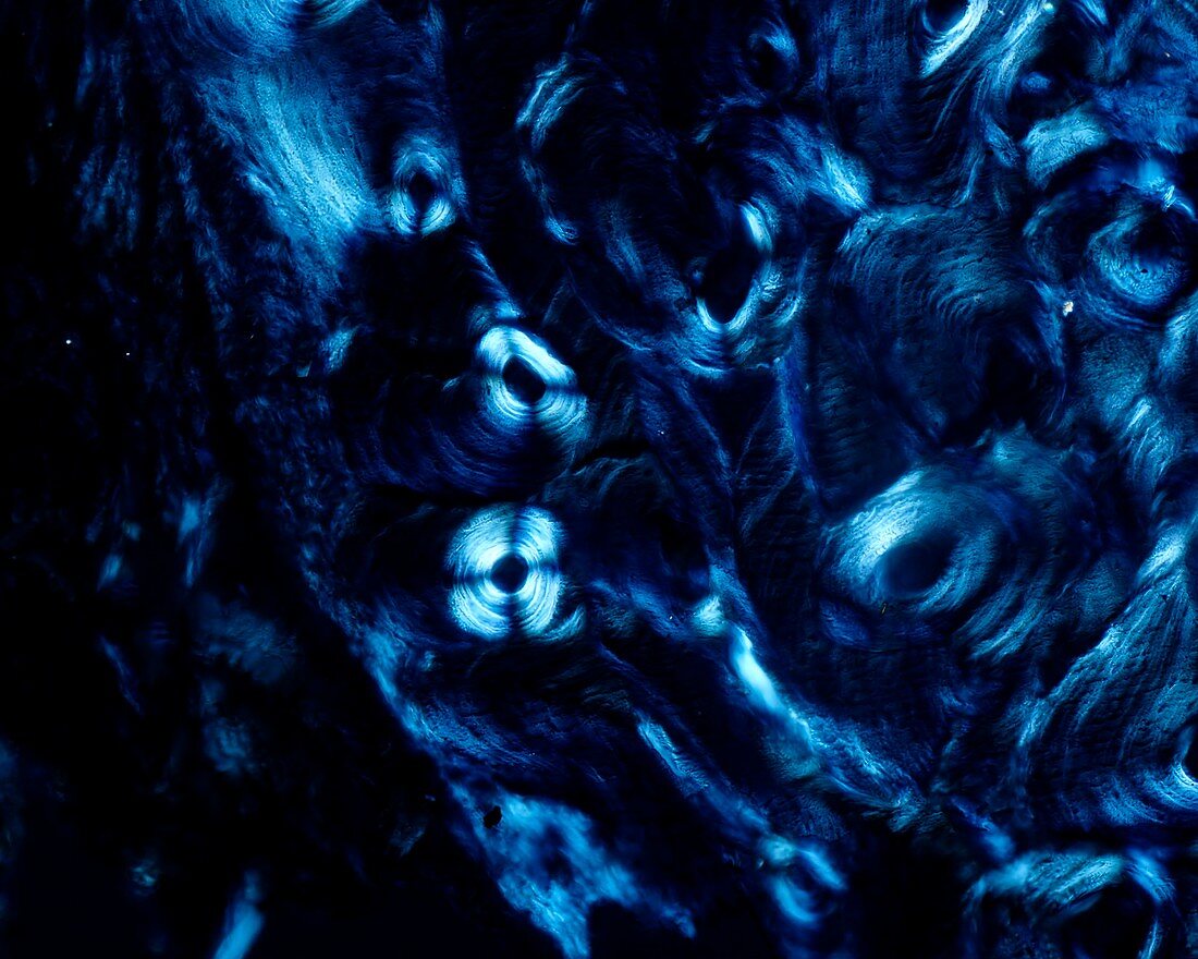 Osteons, polarised light micrograph
