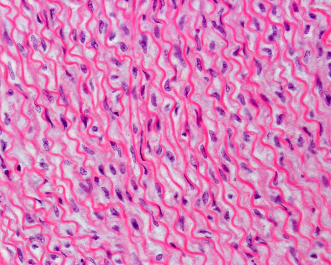 Elastic artery, light micrograph