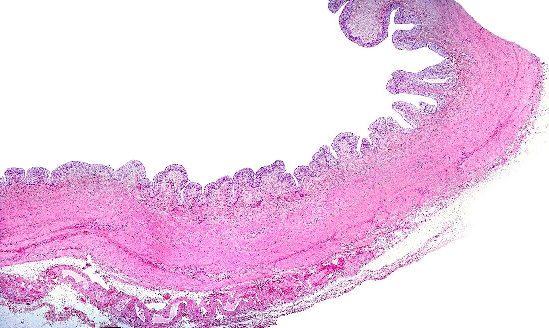 Urinary bladder, light micrograph