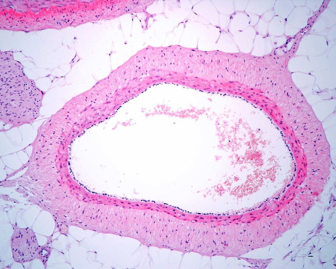 Medium sized vein, light micrograph