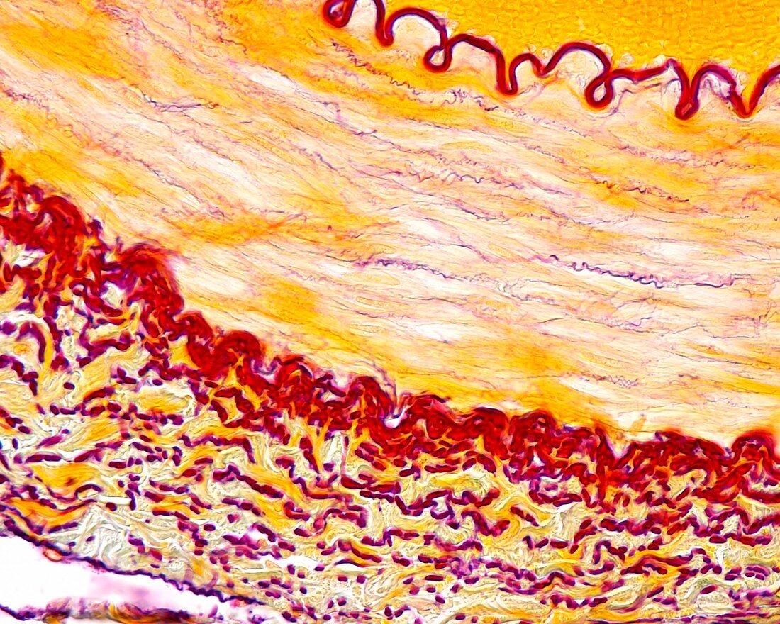Muscular artery, light micrograph
