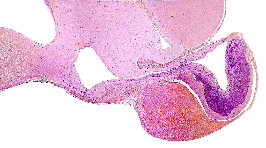 Pituitary gland, light micrograph