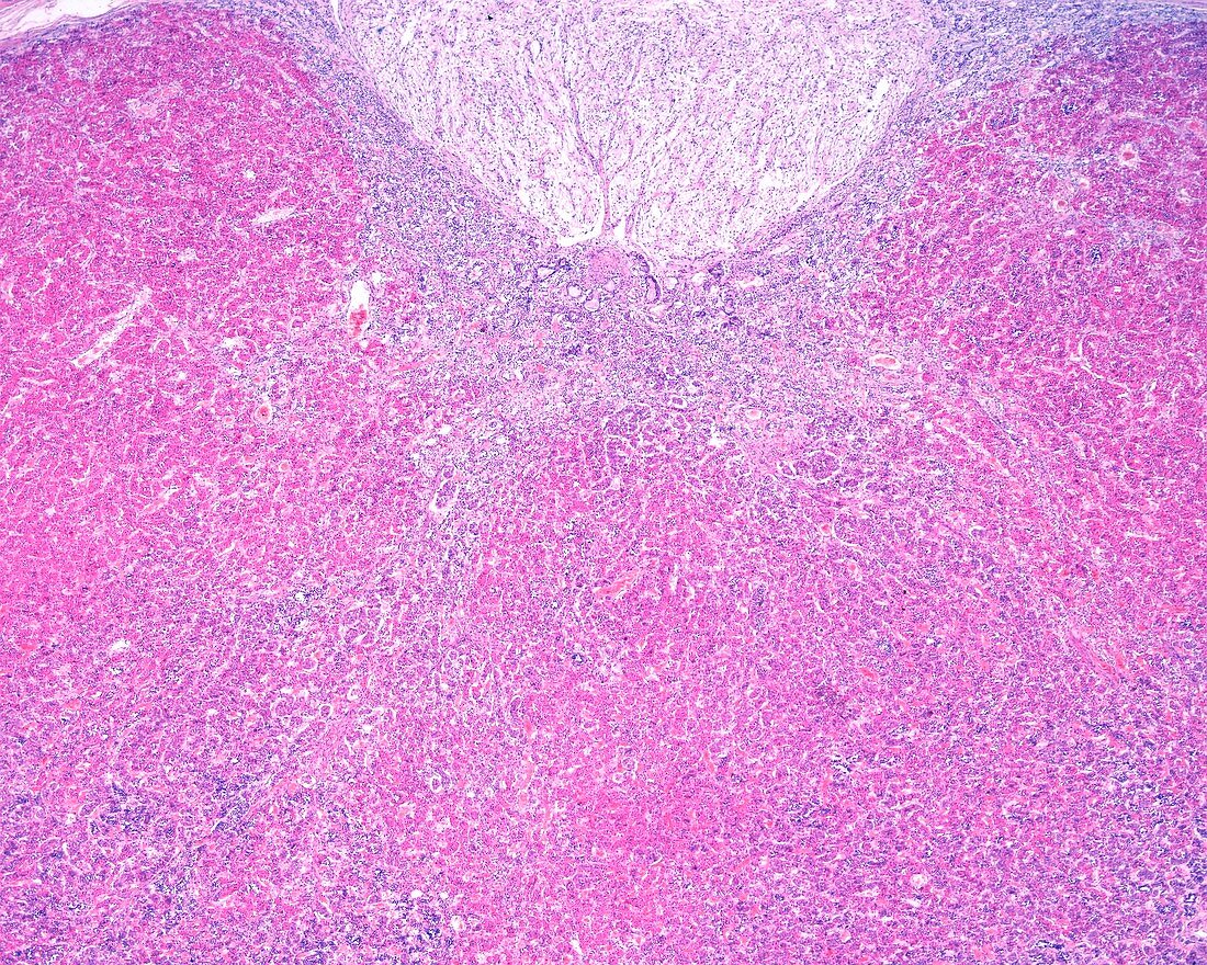 Human pituitary gland, light micrograph