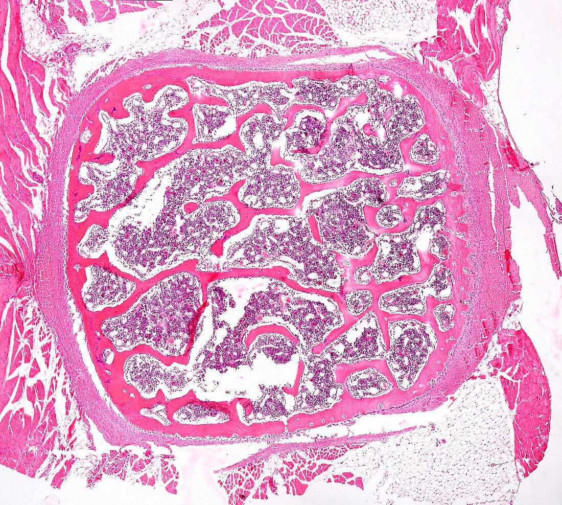 Cancellous bone, light micrograph