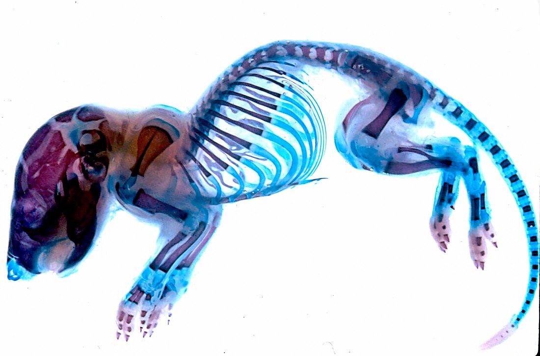 Rat fetal skeleton, light micrograph
