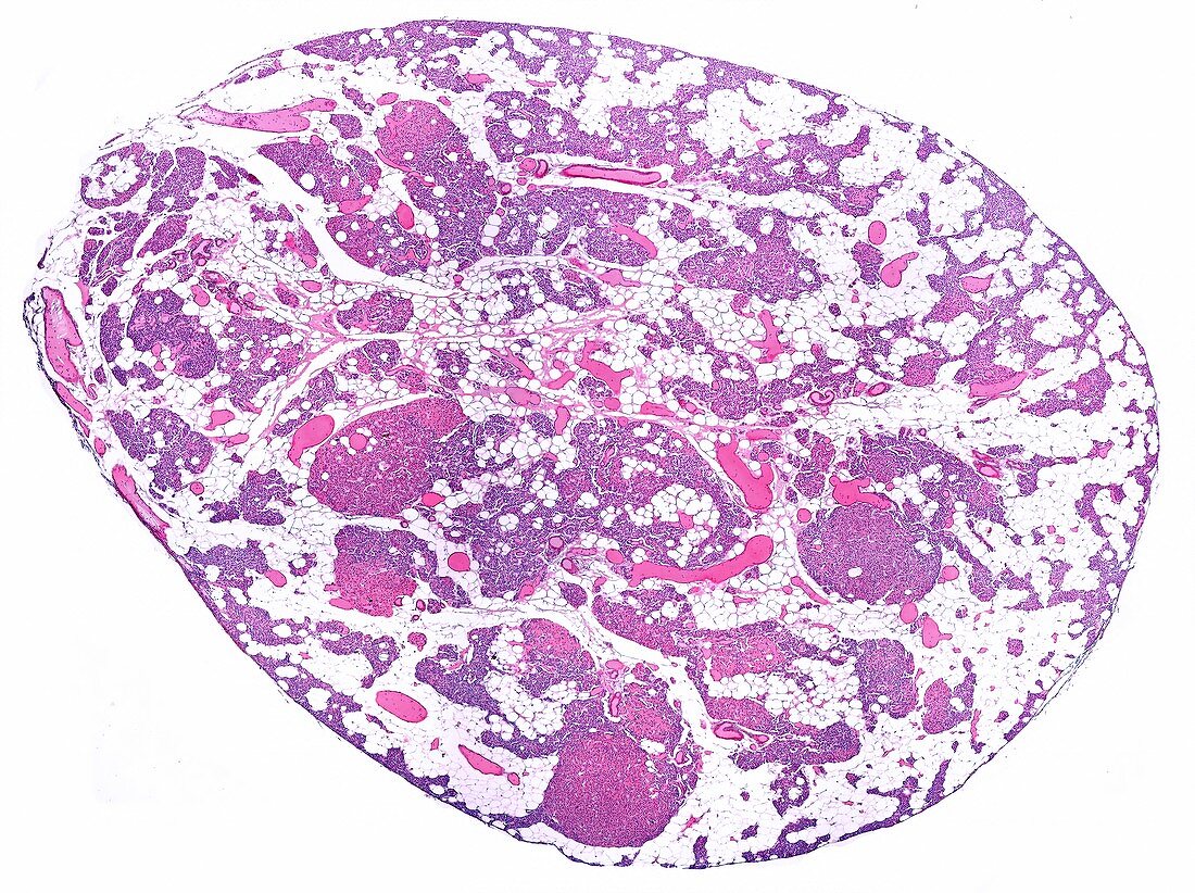 Parathyroid gland, light micrograph
