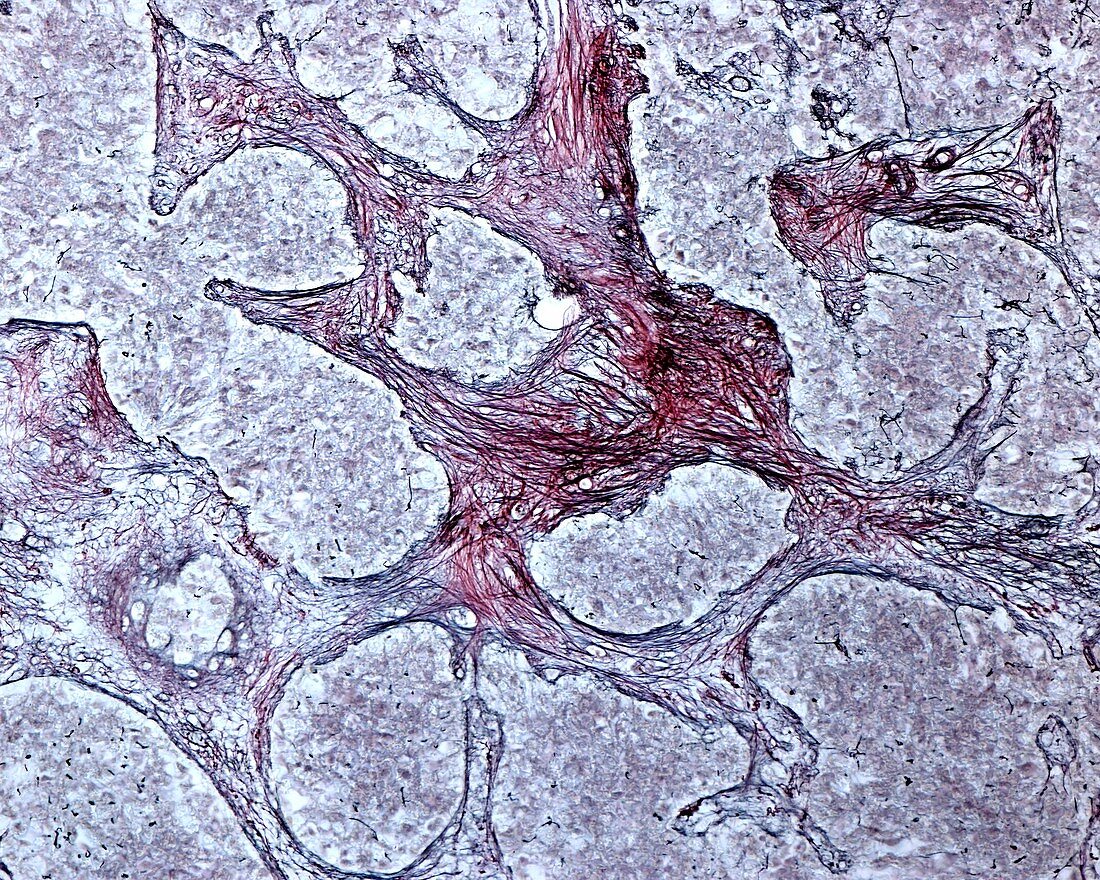 Pineal gland reticular fibres, light micrograph