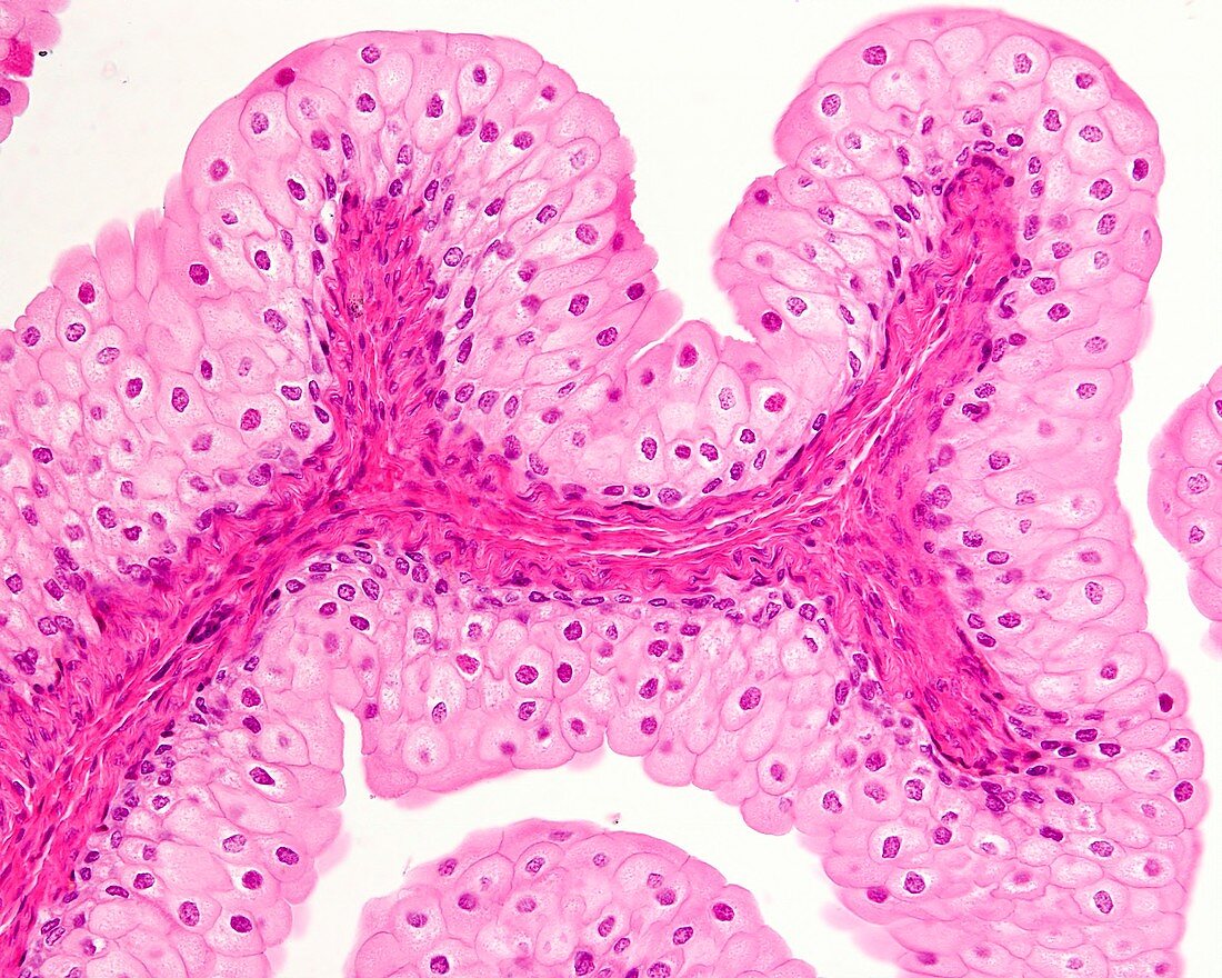 Urinary bladder epithelium, light micrograph