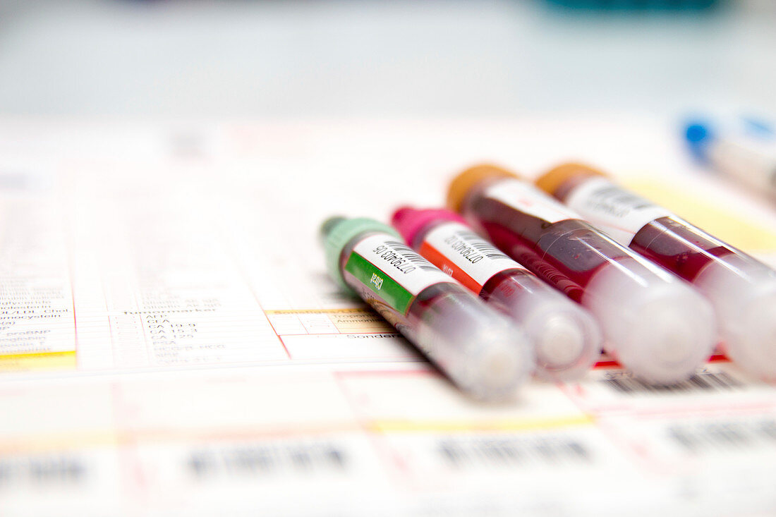 Blood sample analysis