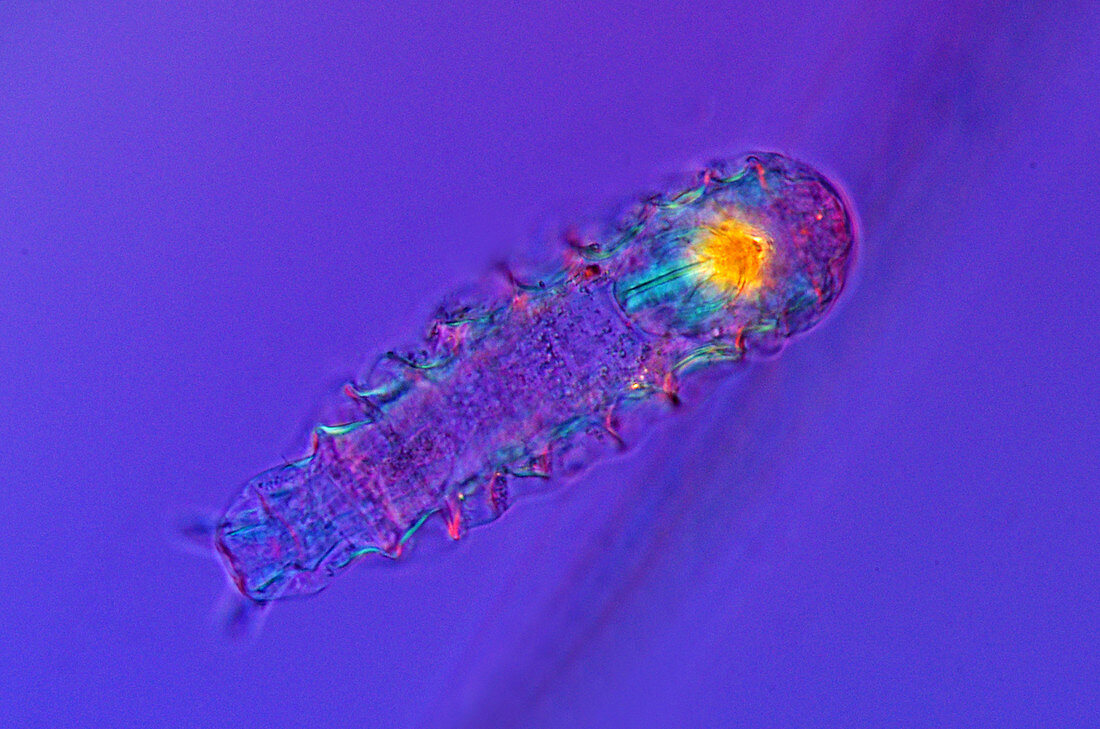 Taphracampa rotifer, light micrograph