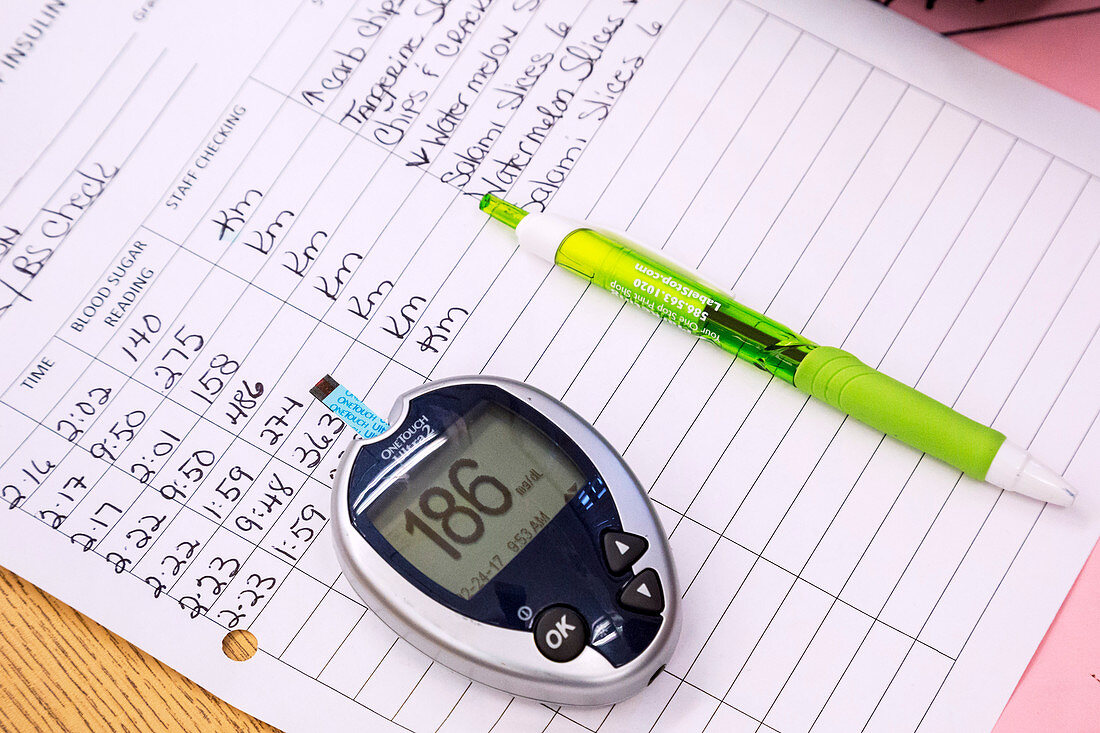 Blood sugar records in type 1 diabetes