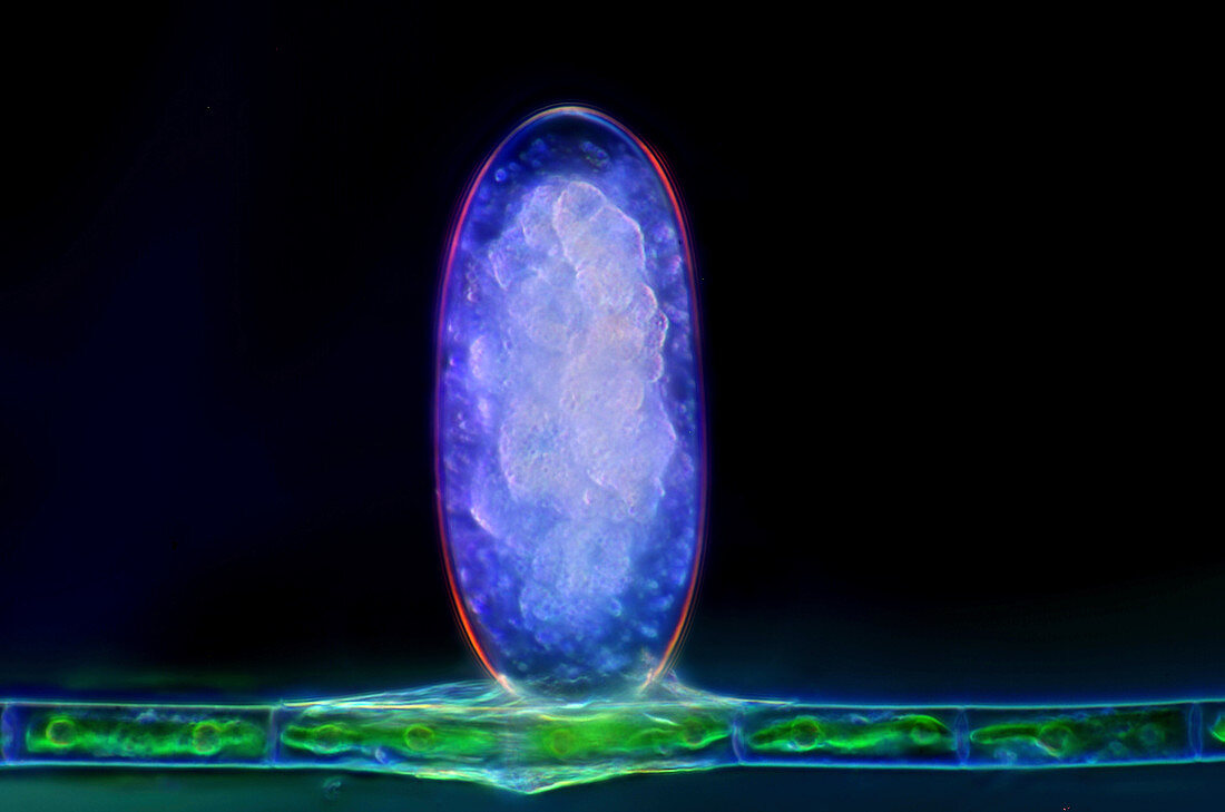 Invertebrate egg on algal filament, light micrograph