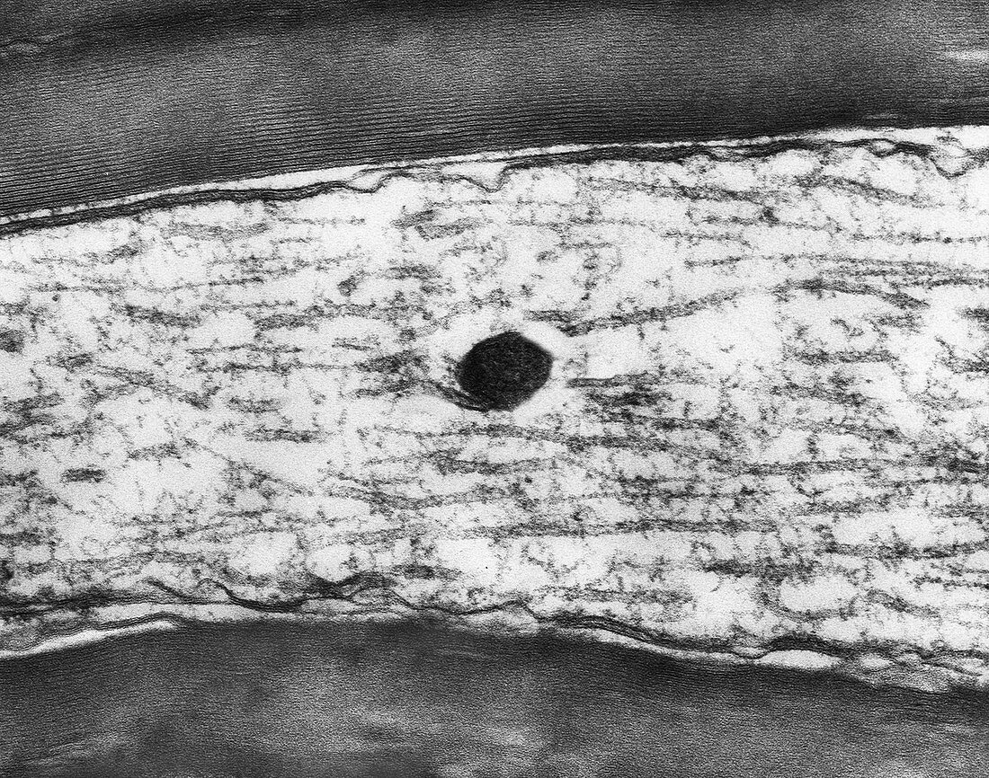 Myelinated axon from CNS, TEM