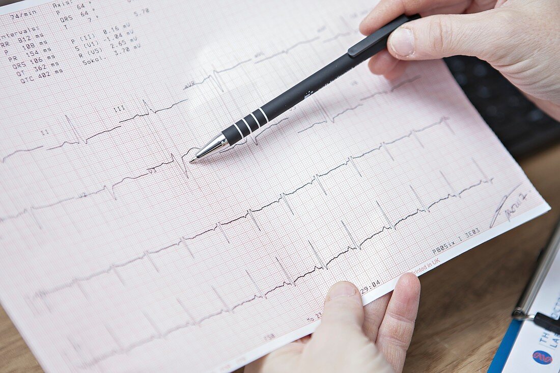 Electrocardiography test results