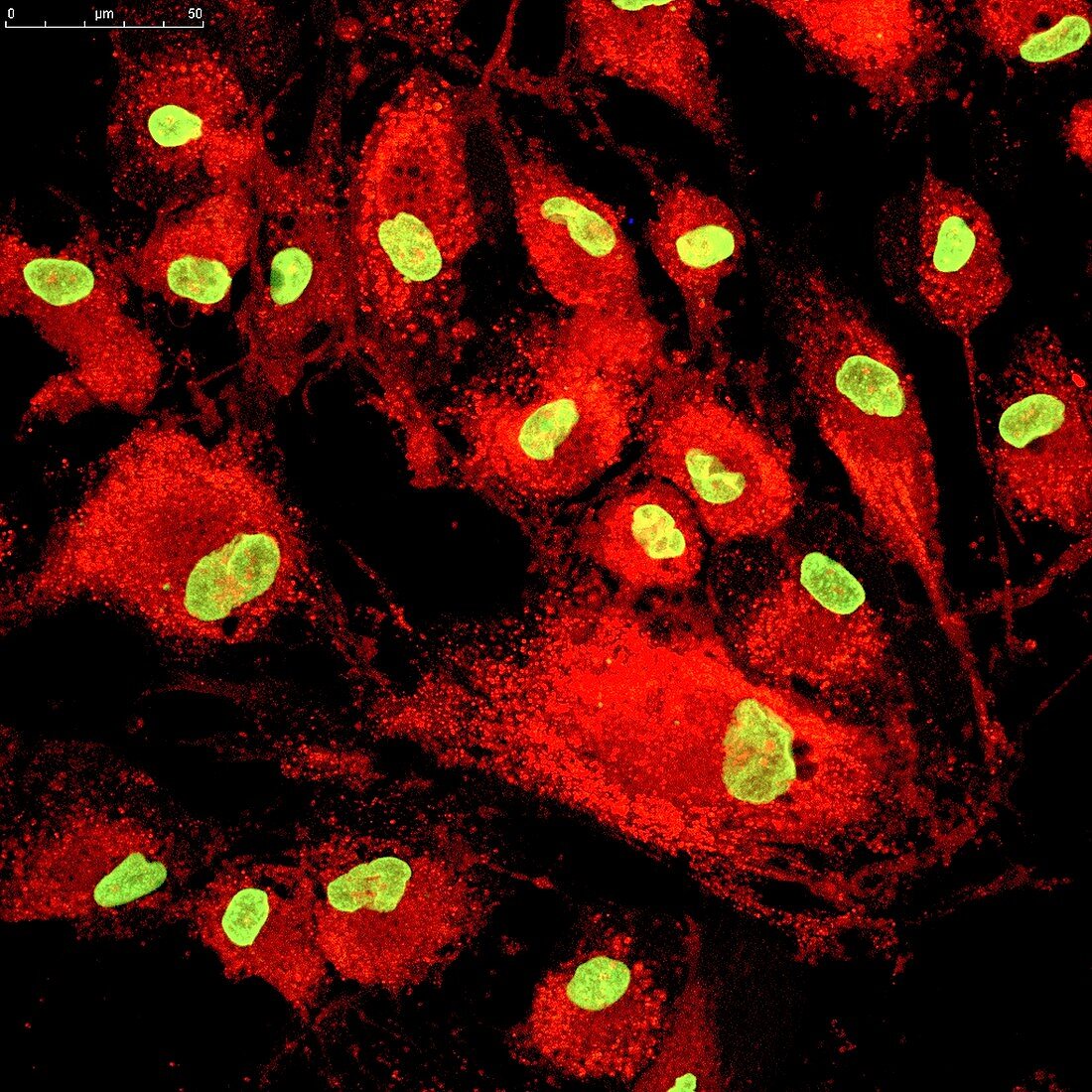 Mesenchymal stem cells, fluorescence light micrograph