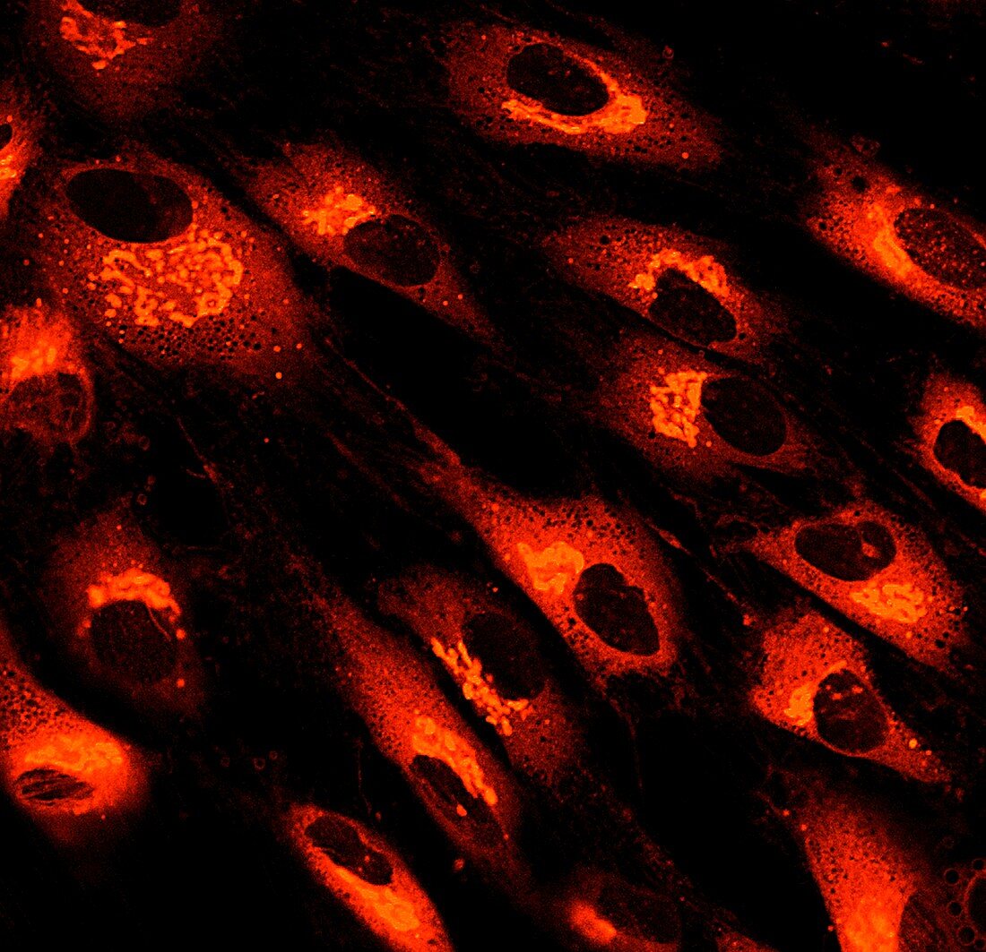 Fibroblast skin cells, fluorescence light micrograph