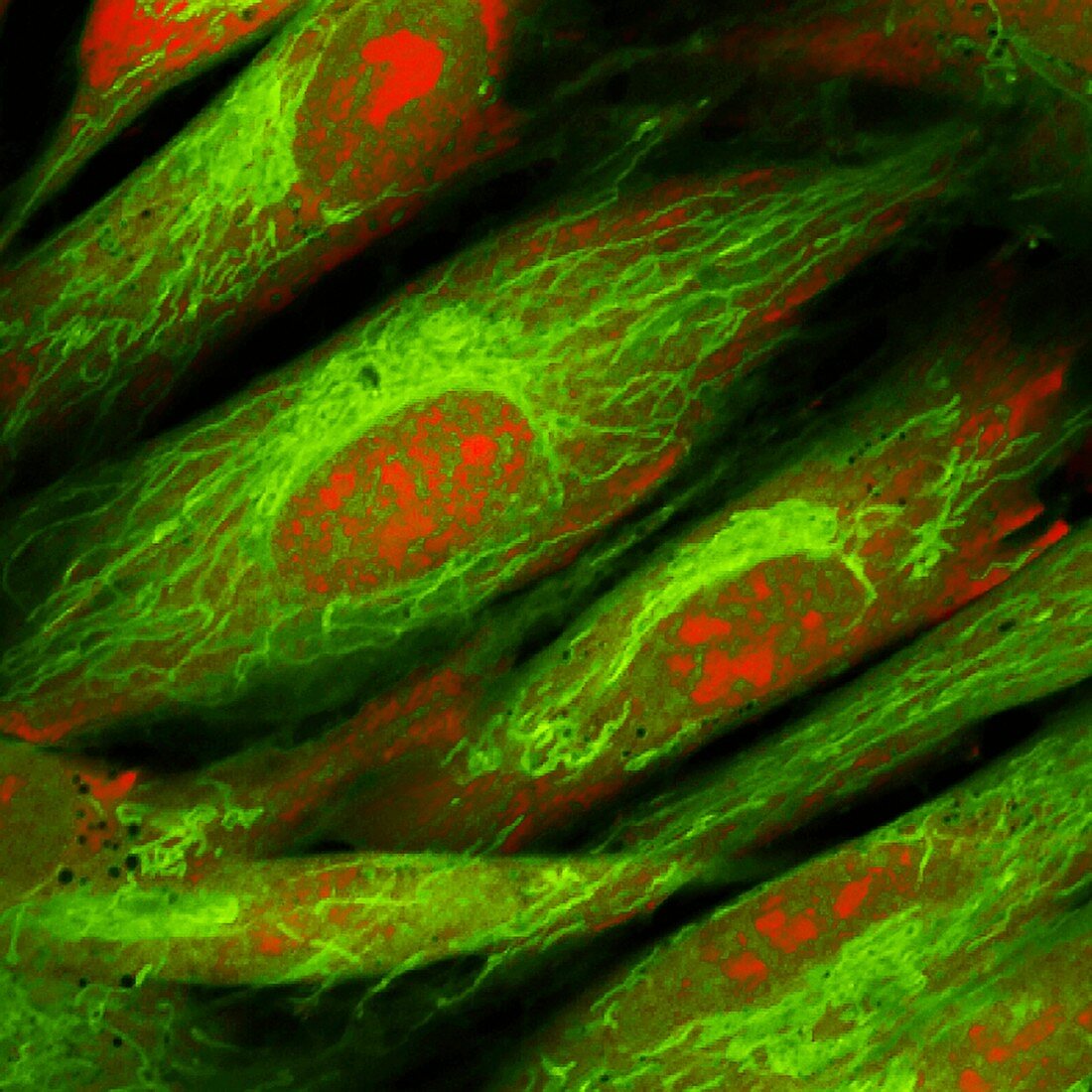 Fibroblast skin cells, fluorescence light micrograph