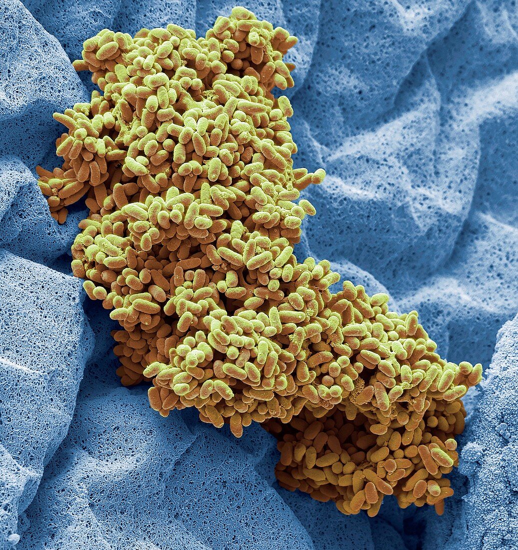 Bacterial culture from raw chicken, SEM
