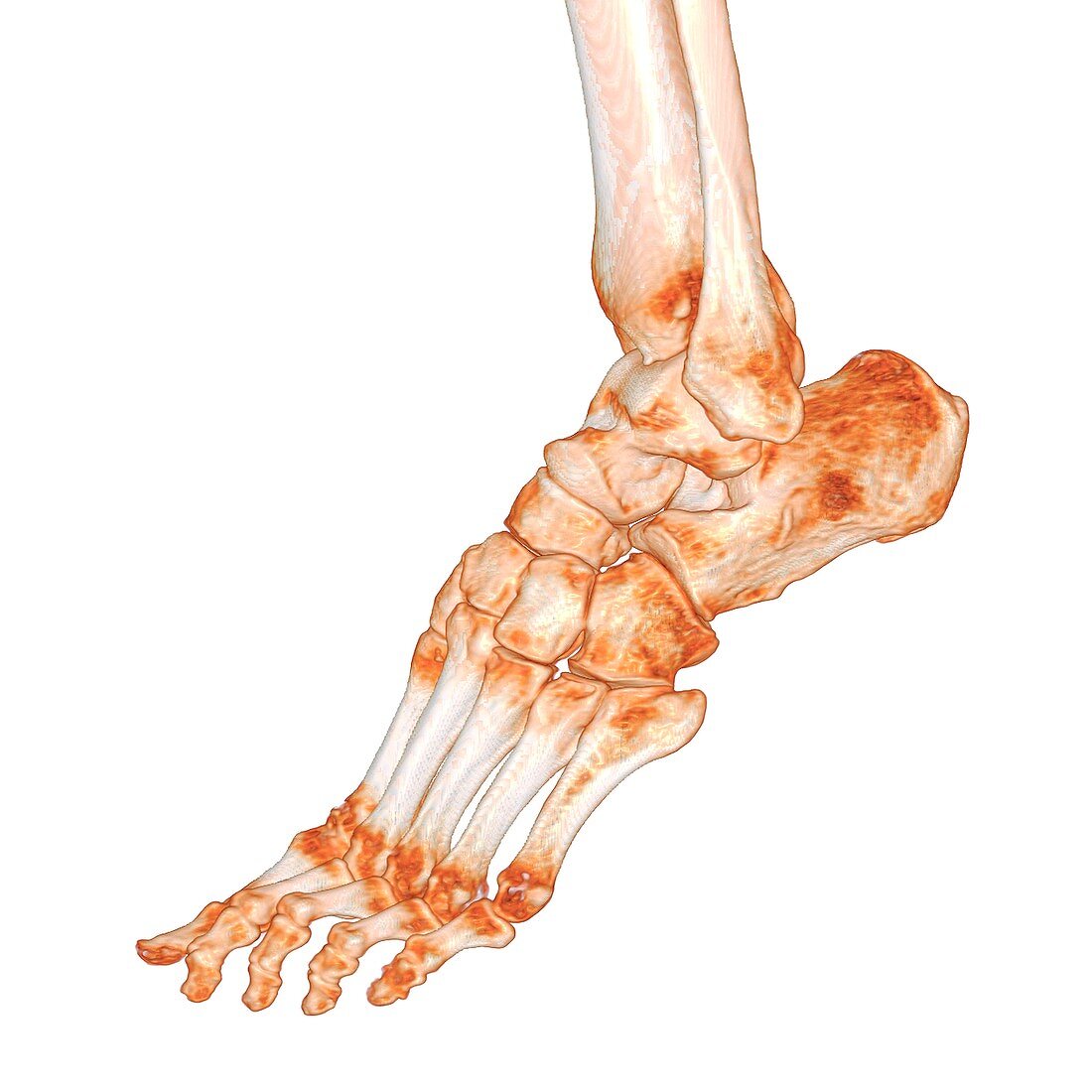 Human foot, 3D CT scan
