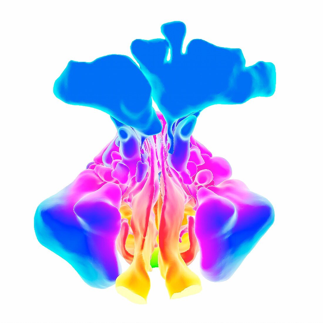 Paranasal sinuses, 3D CT scan