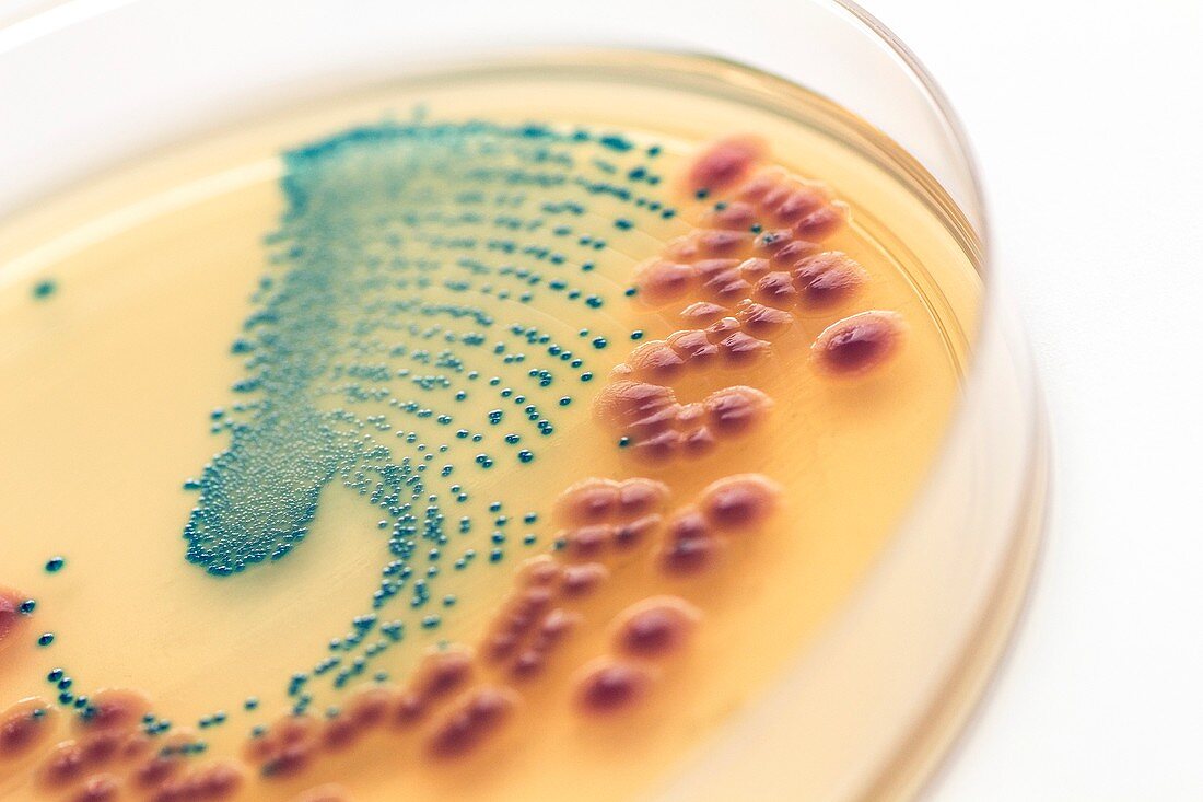 Inhibition of Escherichia coli bacteria