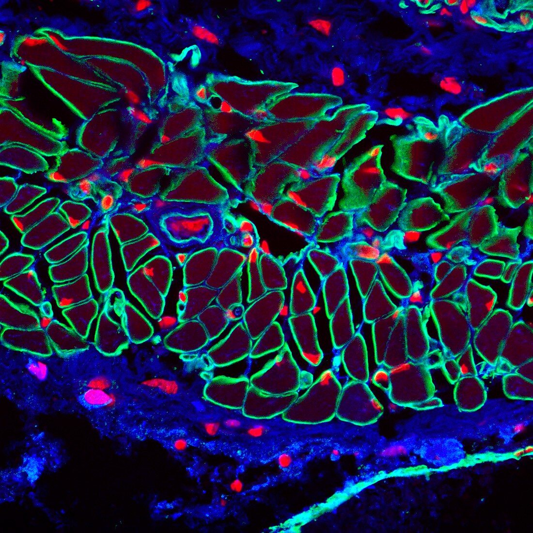 Muscle fibre, confocal fluorescence light micrograph