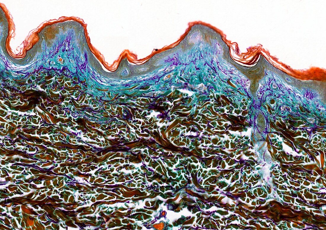 Skin layers, light micrograph