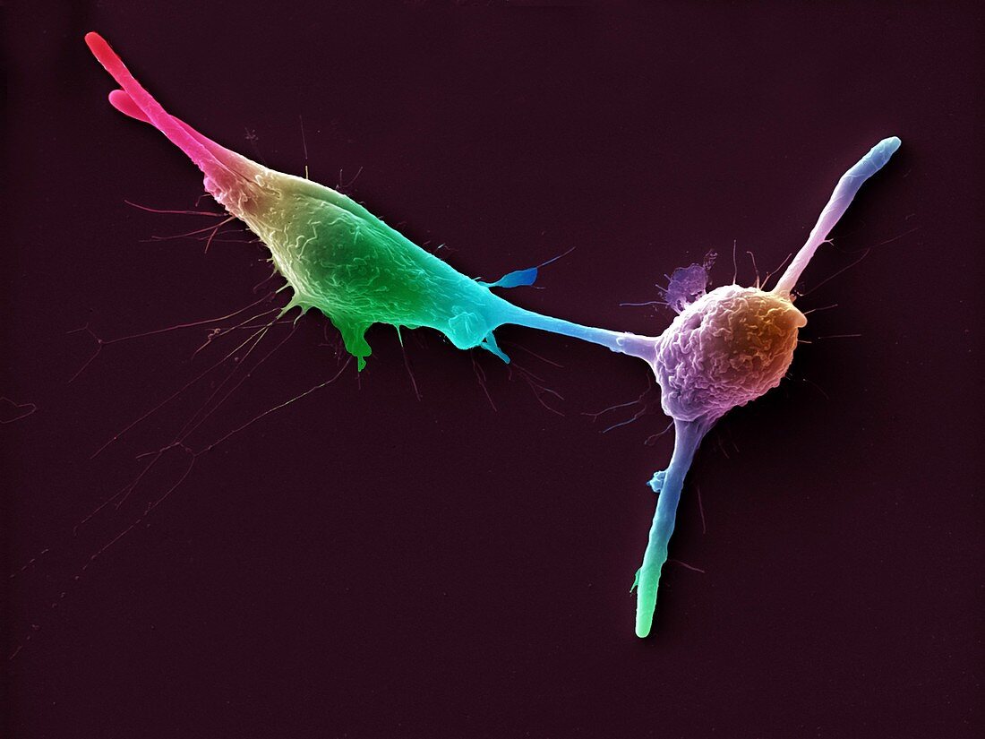 Macrophages infected with Candida yeast spores, SEM