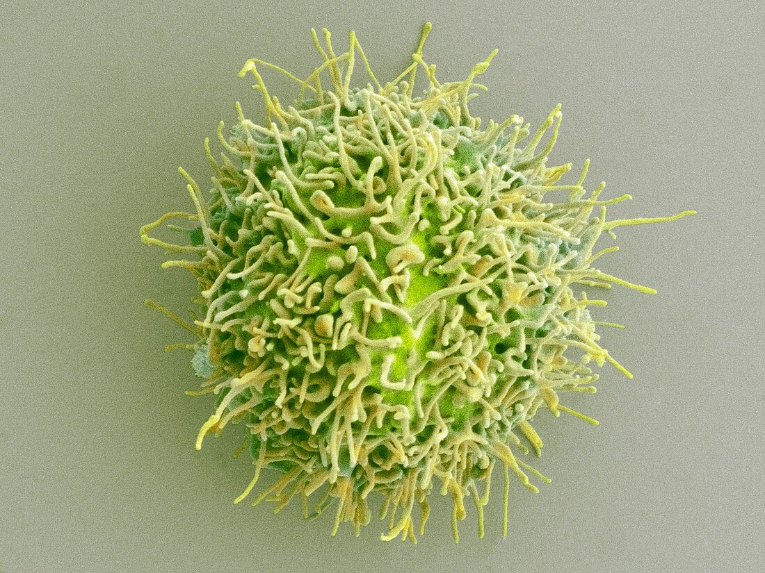 Megakaryocyte, SEM