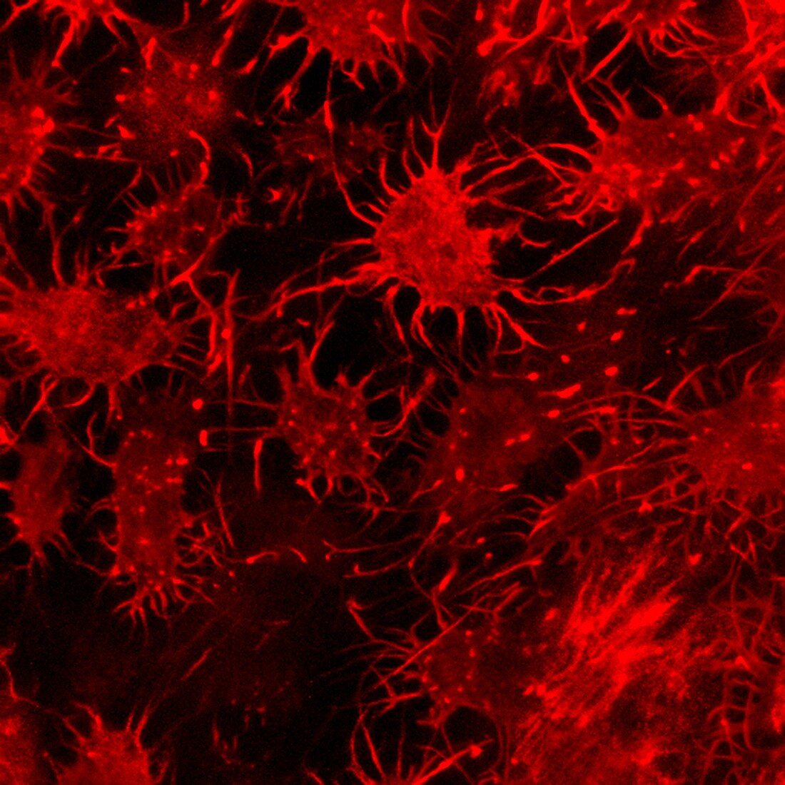 Osteocyte bone cells, fluorescence light micrograph