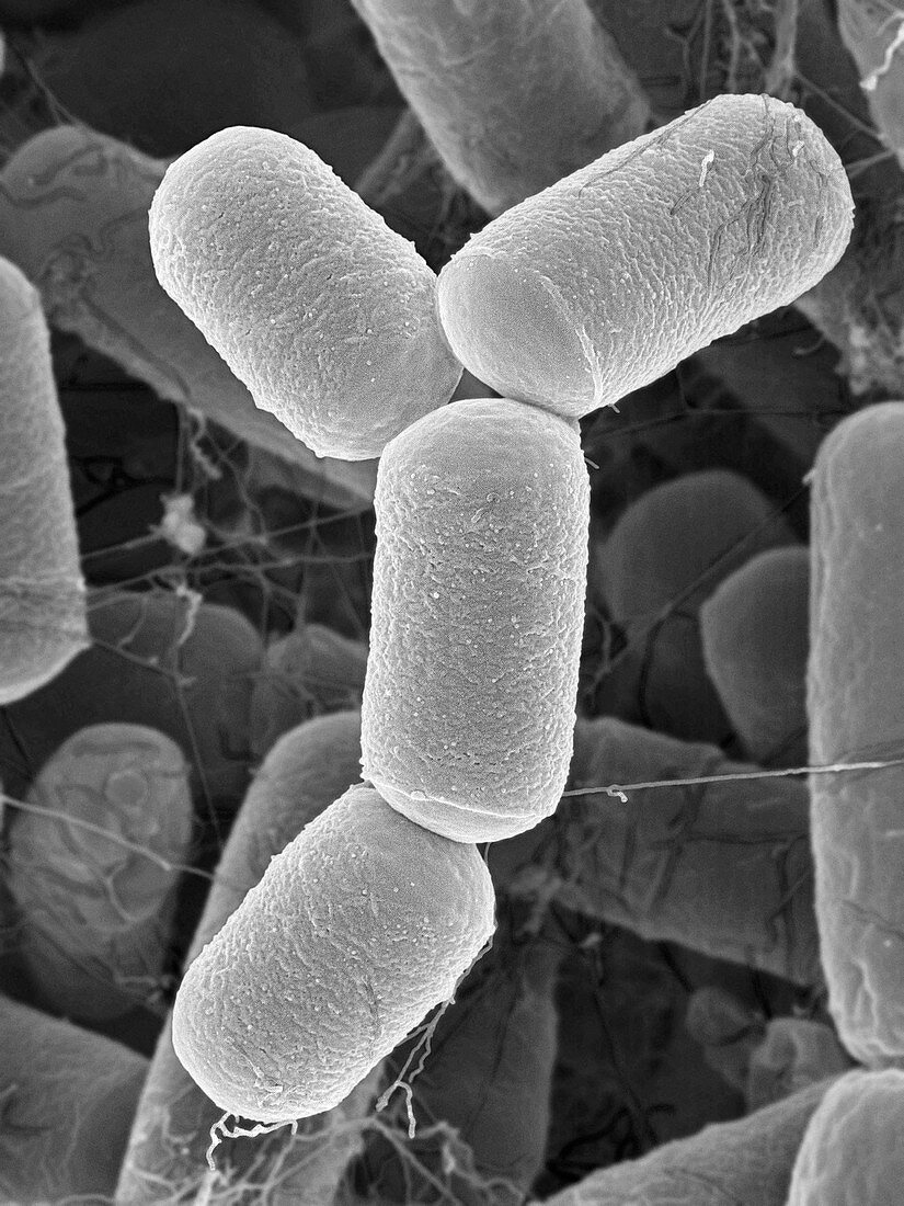 Intestine archaea Methanobrevibacter smithii, SEM