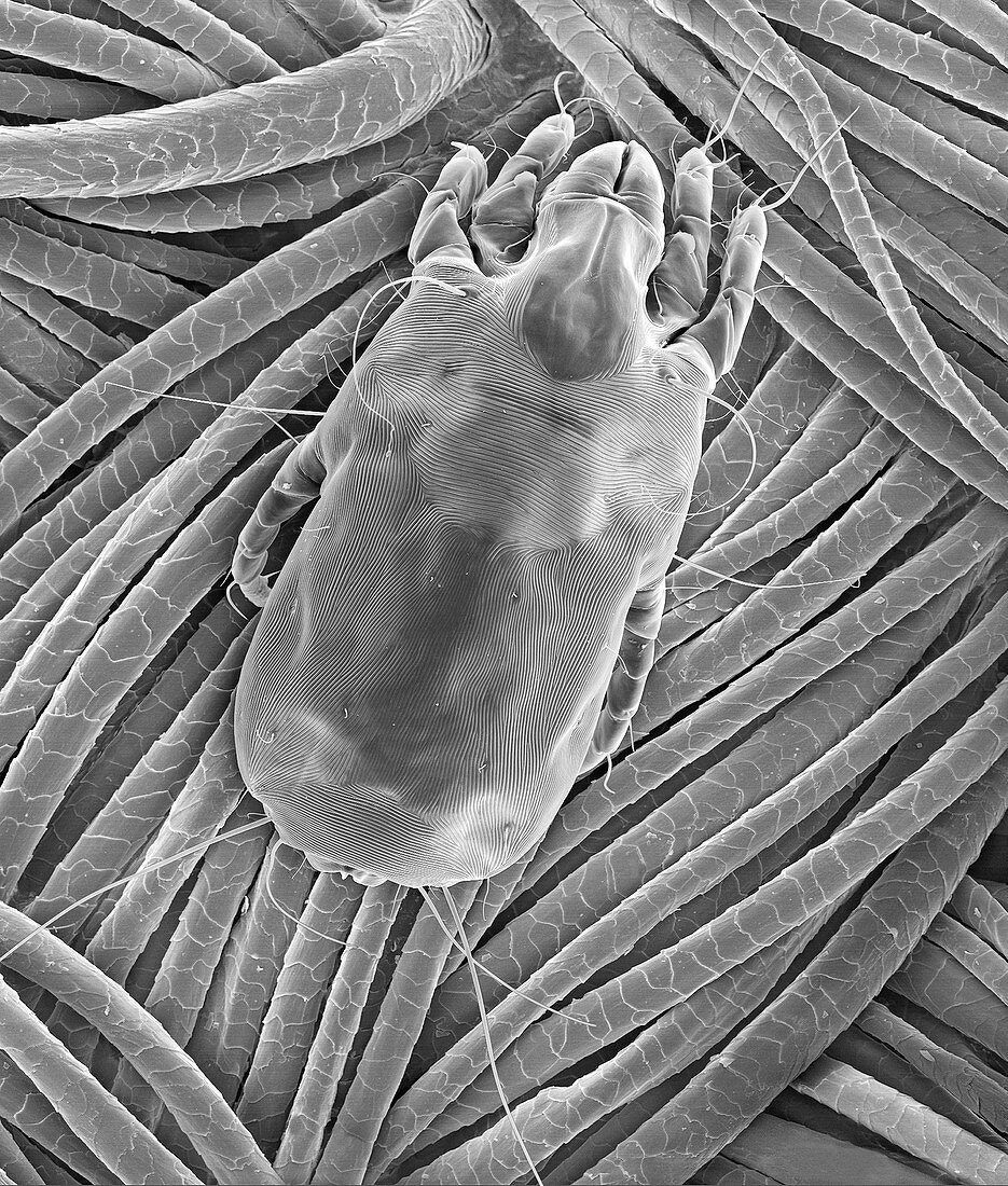 Dust mite on wool fabric, SEM