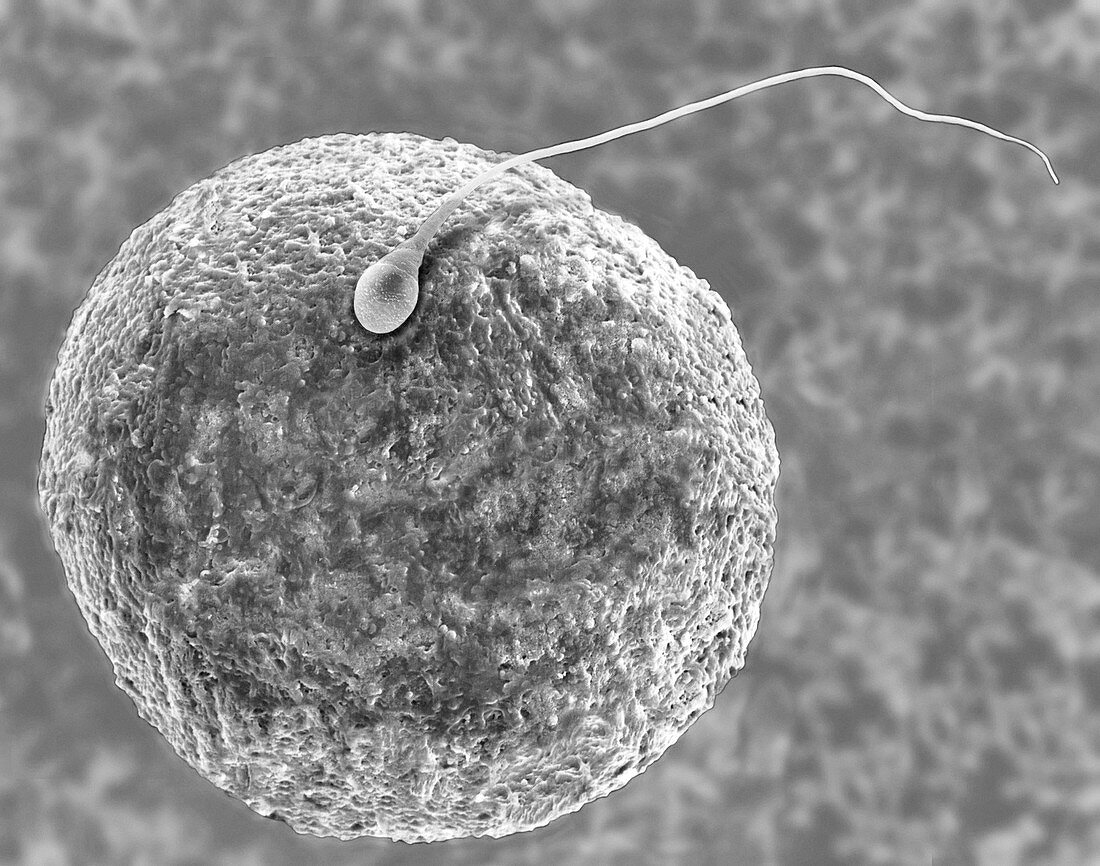 Human egg and sperm, SEM
