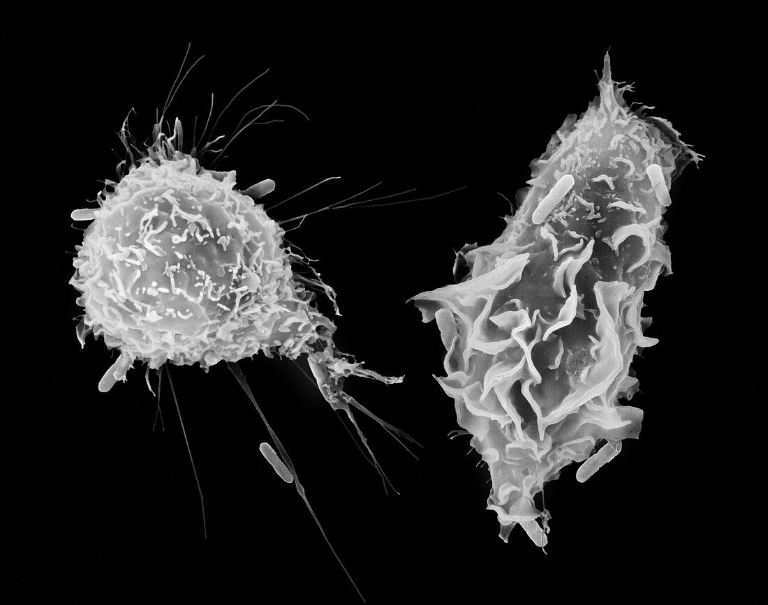 Macrophage and monocyte phagocytosis, SEM