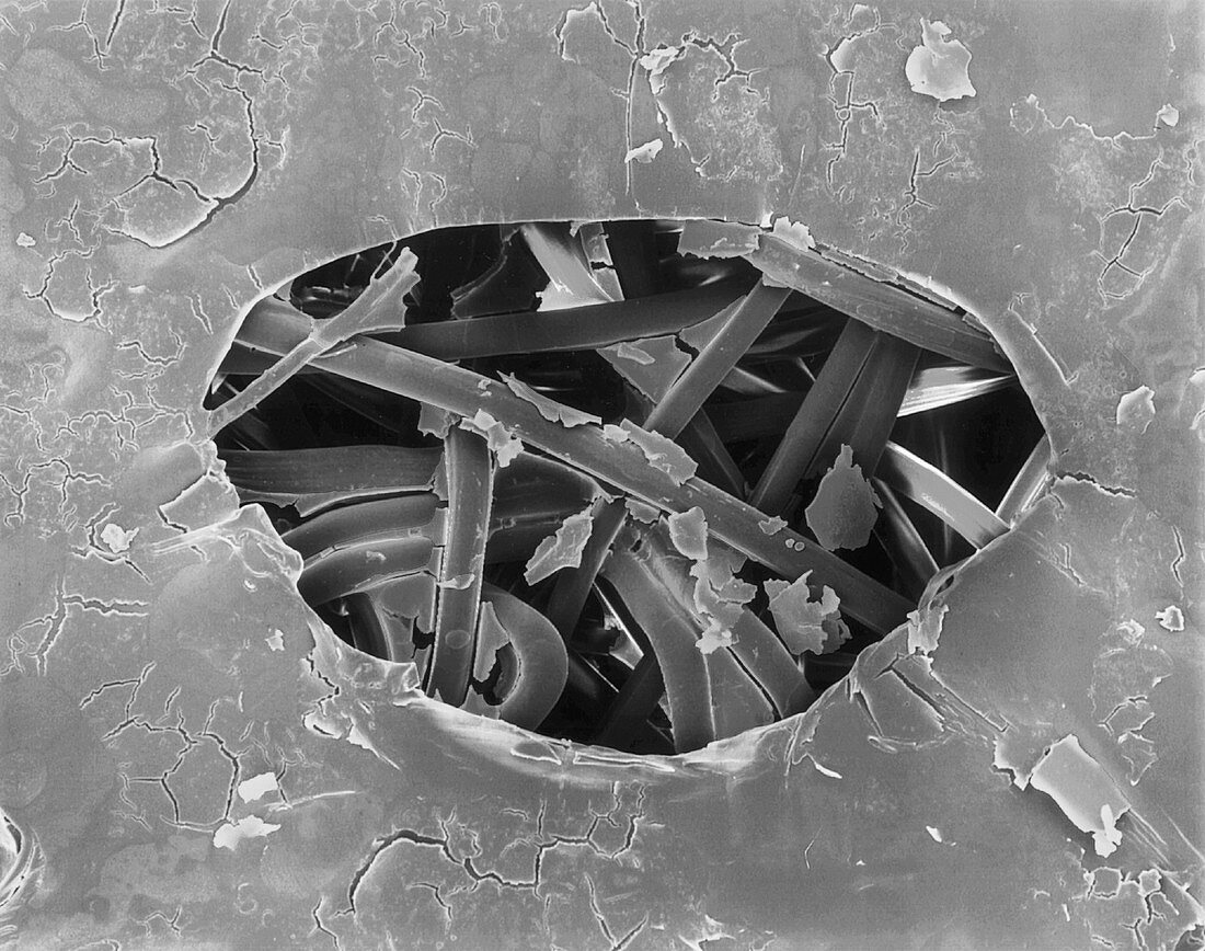 Band-aid with dried blood, SEM