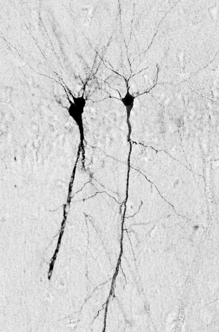Hippocampus pyramidal neurons, LM Brightfield