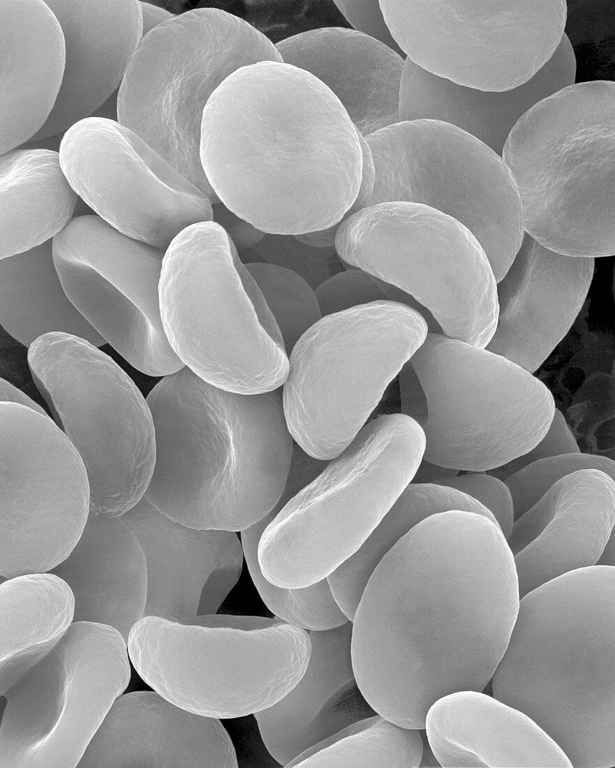 Red blood cells in hypotonic solution, SEM