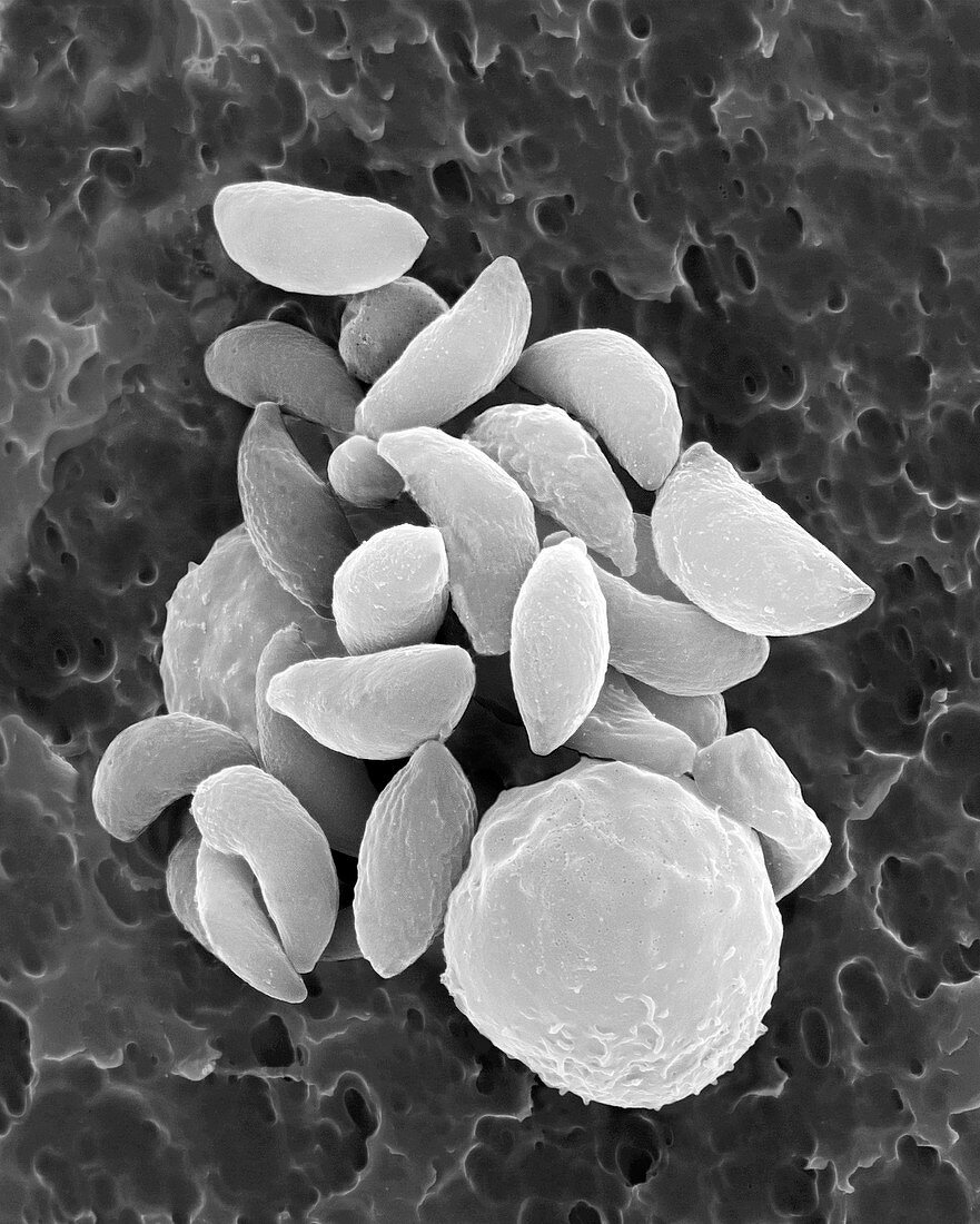 Parasitic protozoan tachyzoites, SEM