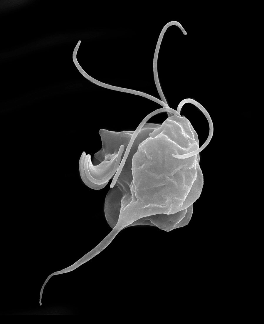Trichomonas vaginalis parasitic protozoan, SEM