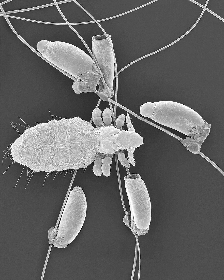 Long-nosed cattle louse and egg cases, SEM