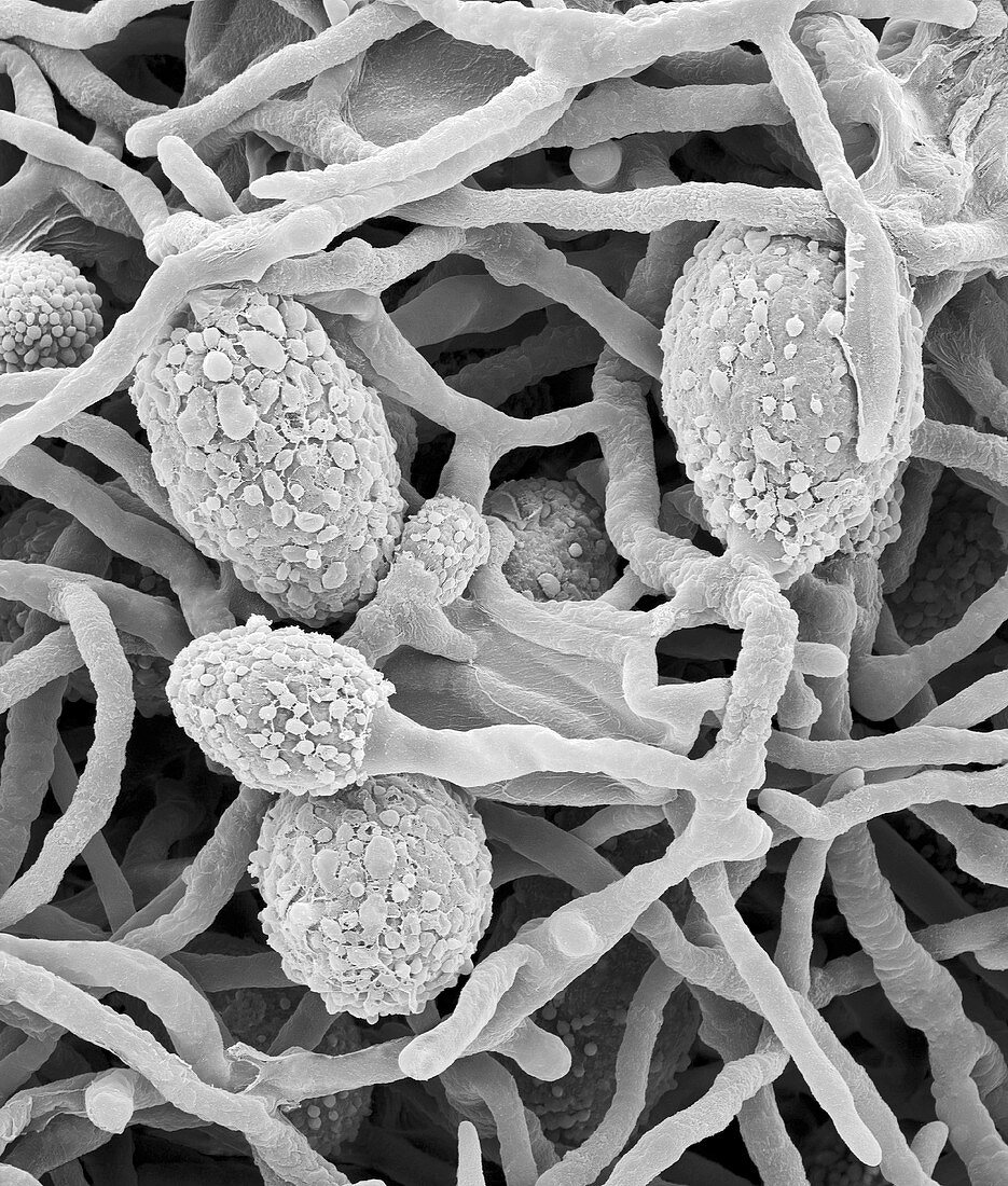 Pithomyces sp. hyphae and fruiting structures, SEM