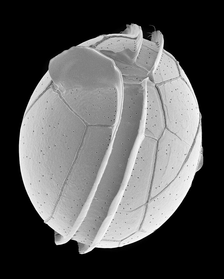 Protoperidinium dinoflagellate, SEM