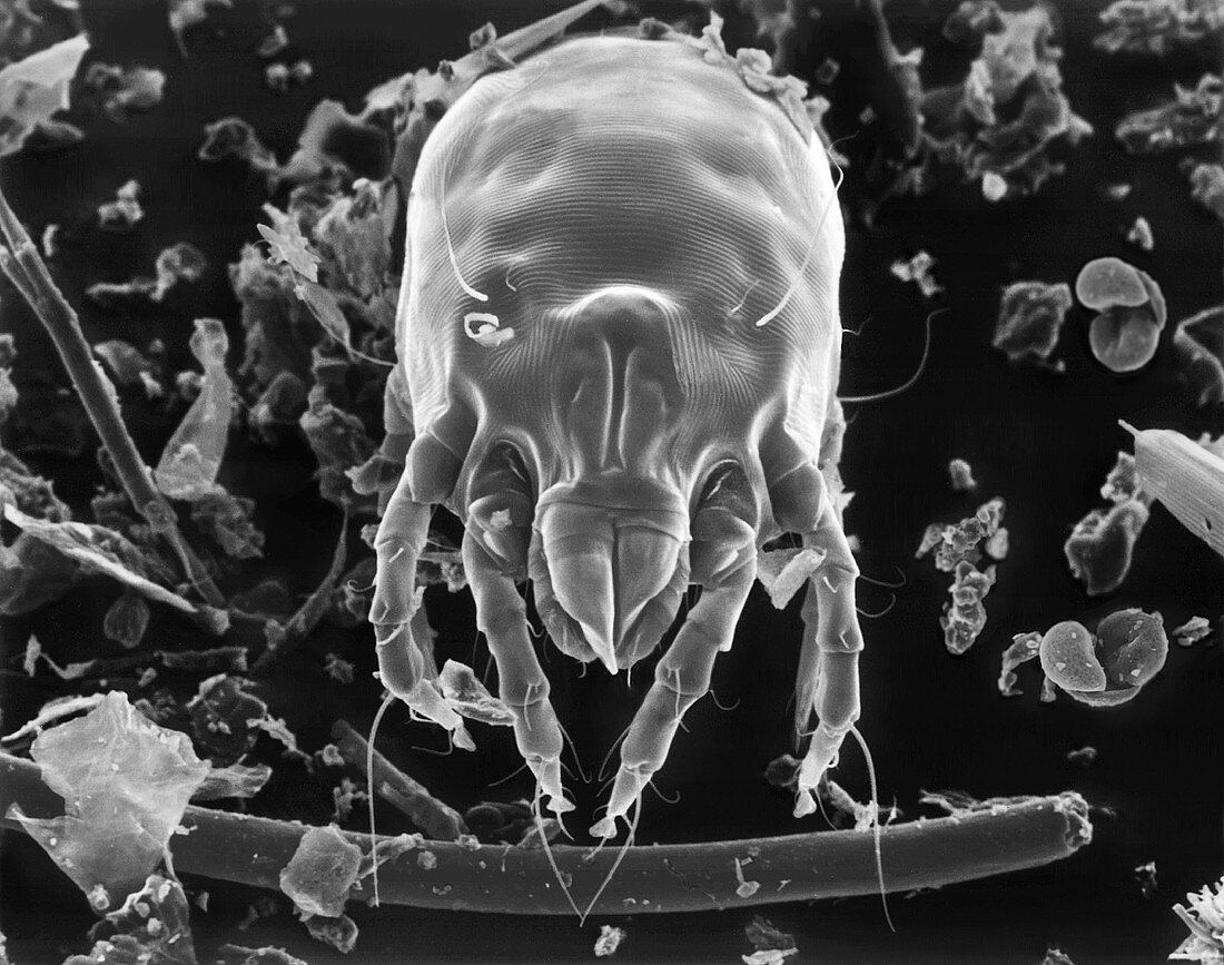 Dust mite, SEM